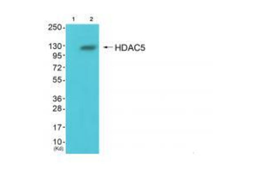 Western blot - HDAC5 Antibody from Signalway Antibody (33401) - Antibodies.com