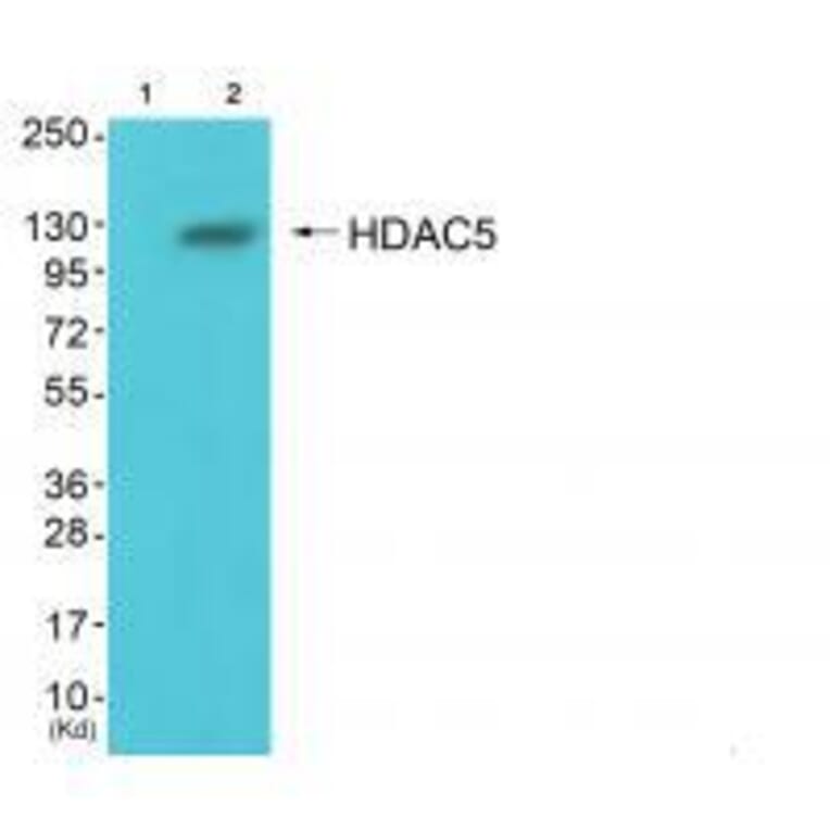 Western blot - HDAC5 Antibody from Signalway Antibody (33401) - Antibodies.com
