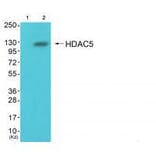Western blot - HDAC5 Antibody from Signalway Antibody (33401) - Antibodies.com