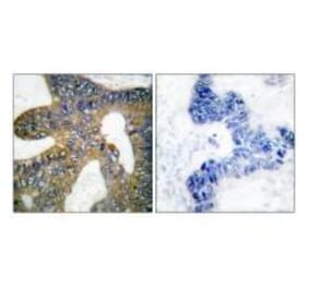 Immunohistochemistry - HSP105 Antibody from Signalway Antibody (33406) - Antibodies.com