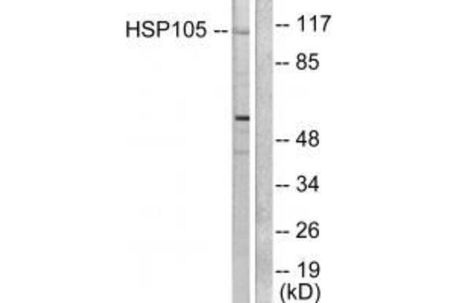 Western blot - HSP105 Antibody from Signalway Antibody (33406) - Antibodies.com