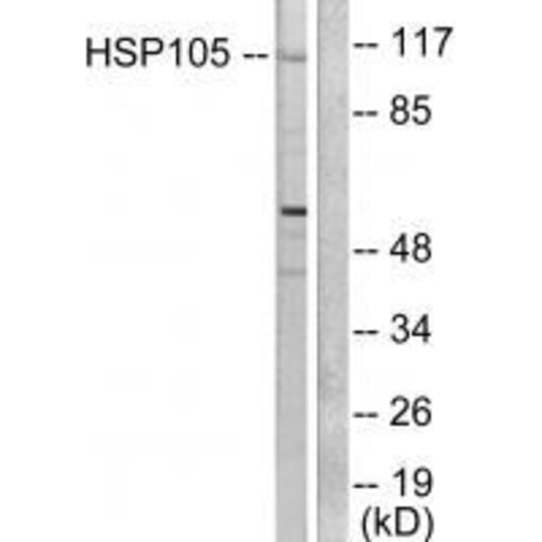 Western blot - HSP105 Antibody from Signalway Antibody (33406) - Antibodies.com