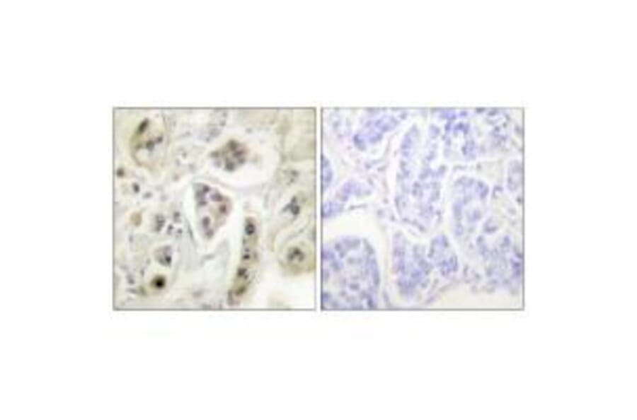 Immunohistochemistry - HSP60 Antibody from Signalway Antibody (33408) - Antibodies.com