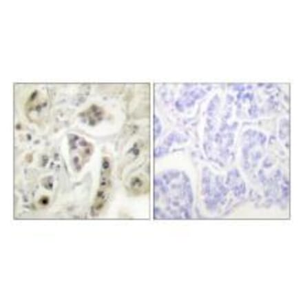 Immunohistochemistry - HSP60 Antibody from Signalway Antibody (33408) - Antibodies.com