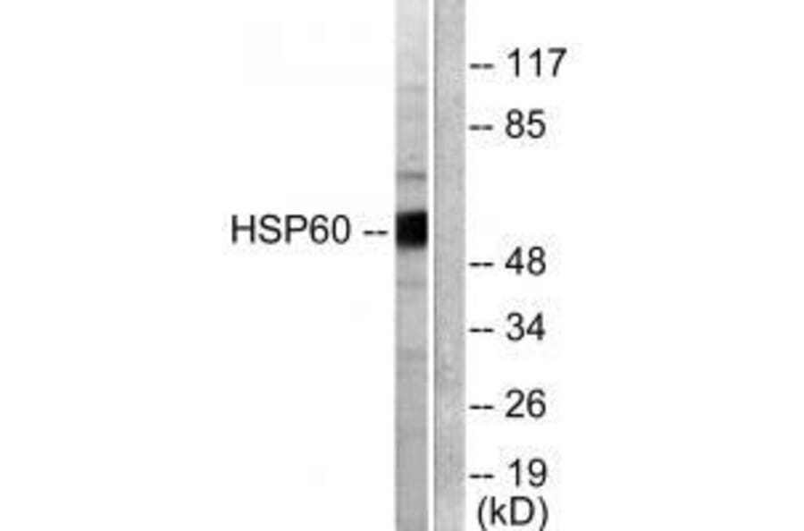 Western blot - HSP60 Antibody from Signalway Antibody (33408) - Antibodies.com