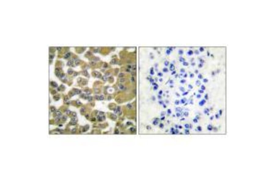 Immunohistochemistry - MMP-11 Antibody from Signalway Antibody (33436) - Antibodies.com