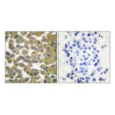 Immunohistochemistry - MMP-11 Antibody from Signalway Antibody (33436) - Antibodies.com