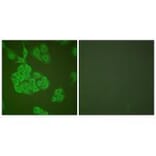 Immunofluorescence - MMP-11 Antibody from Signalway Antibody (33436) - Antibodies.com