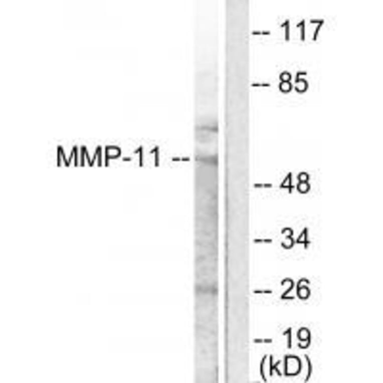 Western blot - MMP-11 Antibody from Signalway Antibody (33436) - Antibodies.com