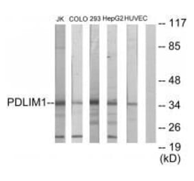 Western blot - PDLIM1 Antibody from Signalway Antibody (33554) - Antibodies.com