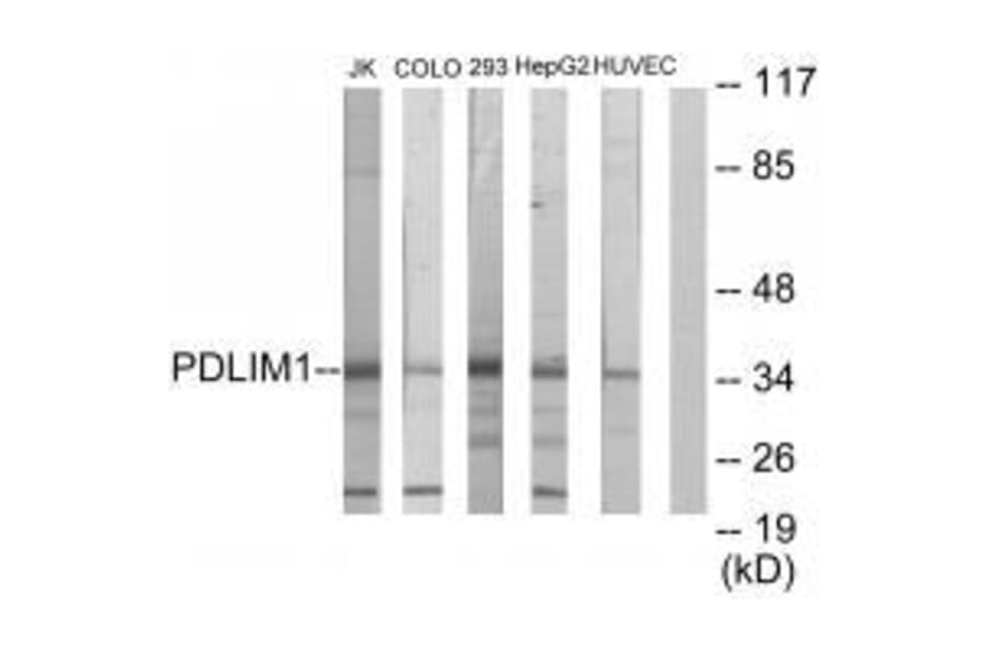 Western blot - PDLIM1 Antibody from Signalway Antibody (33554) - Antibodies.com