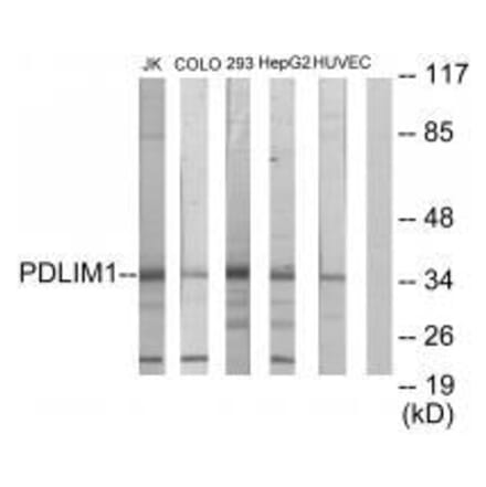 Western blot - PDLIM1 Antibody from Signalway Antibody (33554) - Antibodies.com