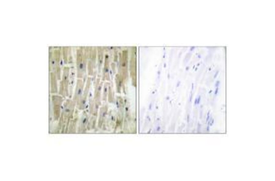 Immunohistochemistry - PDLIM1 Antibody from Signalway Antibody (33554) - Antibodies.com
