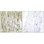 Immunohistochemistry - PDLIM1 Antibody from Signalway Antibody (33554) - Antibodies.com