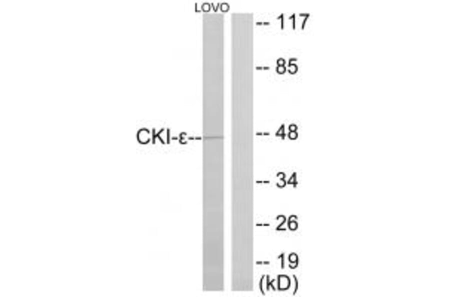 Western blot - CKI-ε Antibody from Signalway Antibody (33782) - Antibodies.com