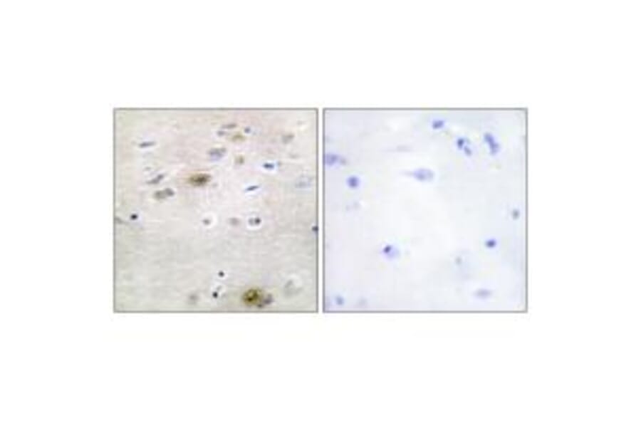 Immunohistochemistry - TRA-2α Antibody from Signalway Antibody (33872) - Antibodies.com