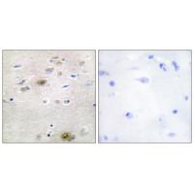 Immunohistochemistry - TRA-2α Antibody from Signalway Antibody (33872) - Antibodies.com