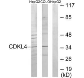 Western blot - CDKL4 Antibody from Signalway Antibody (33928) - Antibodies.com