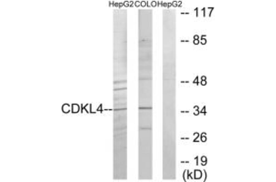 Western blot - CDKL4 Antibody from Signalway Antibody (33928) - Antibodies.com