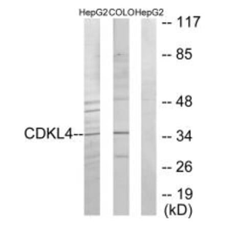 Western blot - CDKL4 Antibody from Signalway Antibody (33928) - Antibodies.com