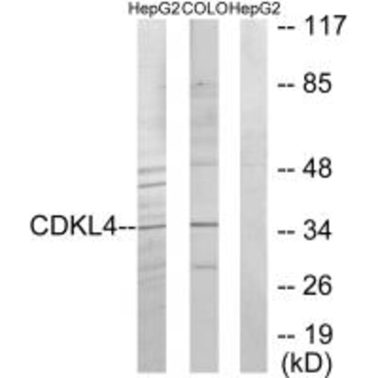 Western blot - CDKL4 Antibody from Signalway Antibody (33928) - Antibodies.com