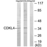 Western blot - CDKL4 Antibody from Signalway Antibody (33928) - Antibodies.com