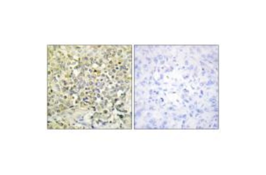 Immunohistochemistry - CDKL4 Antibody from Signalway Antibody (33928) - Antibodies.com