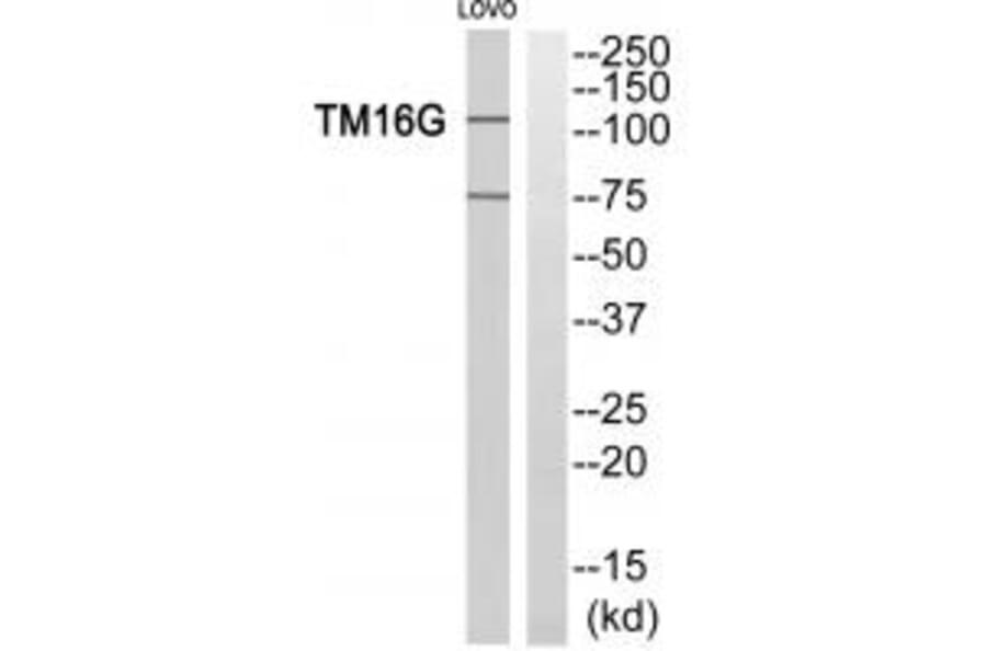 Western blot - TM16G Antibody from Signalway Antibody (33935) - Antibodies.com