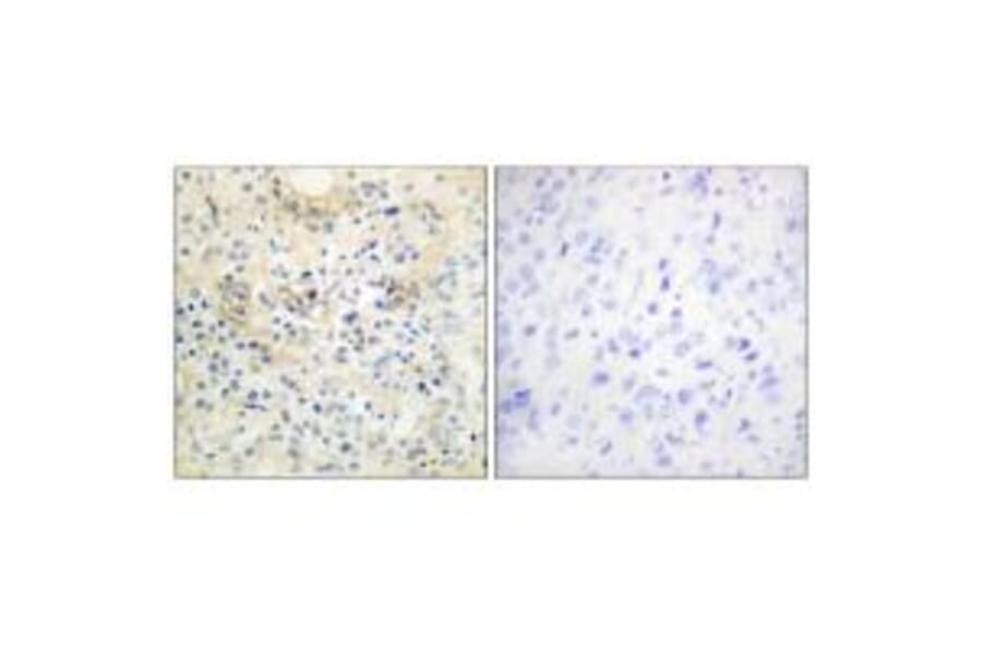 Immunohistochemistry - TM16G Antibody from Signalway Antibody (33935) - Antibodies.com