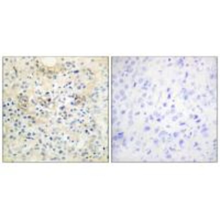 Immunohistochemistry - TM16G Antibody from Signalway Antibody (33935) - Antibodies.com