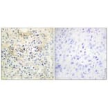 Immunohistochemistry - TM16G Antibody from Signalway Antibody (33935) - Antibodies.com