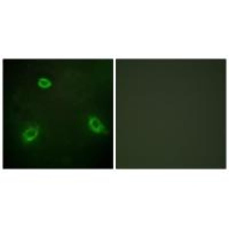 Immunofluorescence - TM16G Antibody from Signalway Antibody (33935) - Antibodies.com