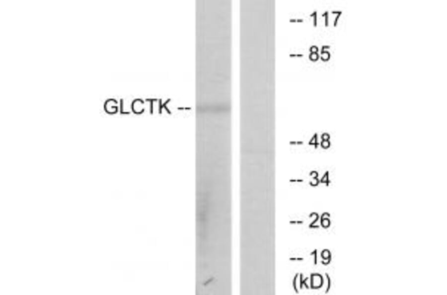 Western blot - GLCTK Antibody from Signalway Antibody (33958) - Antibodies.com