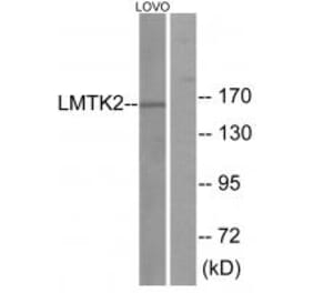 Western blot - LMTK2 Antibody from Signalway Antibody (33961) - Antibodies.com