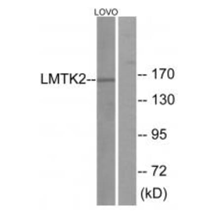Western blot - LMTK2 Antibody from Signalway Antibody (33961) - Antibodies.com