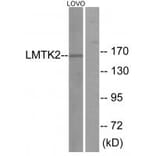 Western blot - LMTK2 Antibody from Signalway Antibody (33961) - Antibodies.com