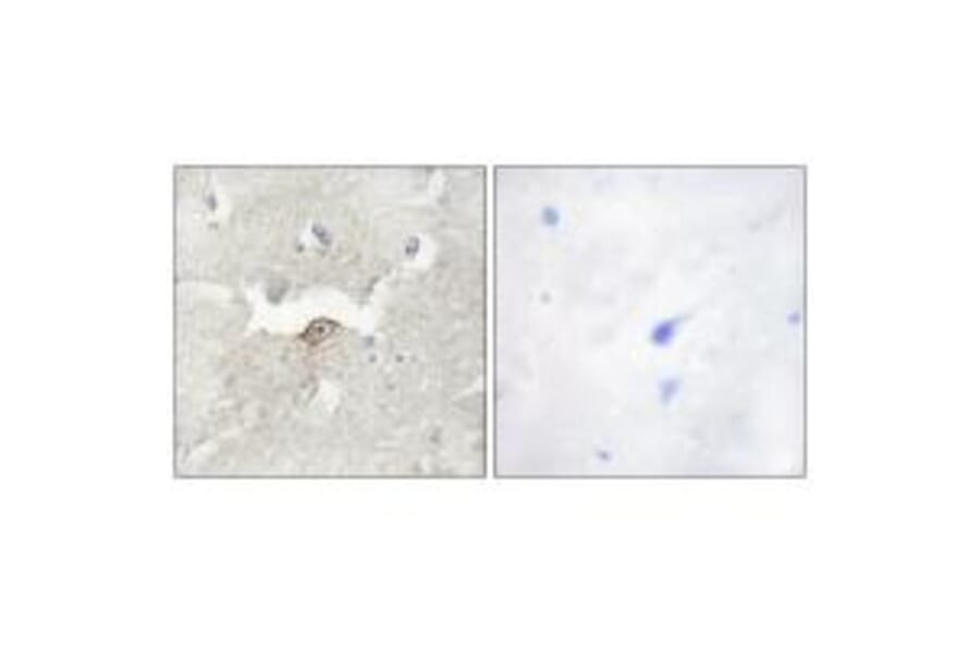 Immunohistochemistry - LMTK2 Antibody from Signalway Antibody (33961) - Antibodies.com