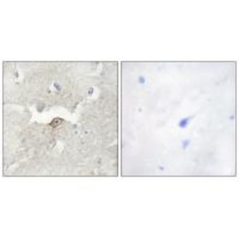 Immunohistochemistry - LMTK2 Antibody from Signalway Antibody (33961) - Antibodies.com