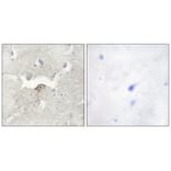 Immunohistochemistry - LMTK2 Antibody from Signalway Antibody (33961) - Antibodies.com