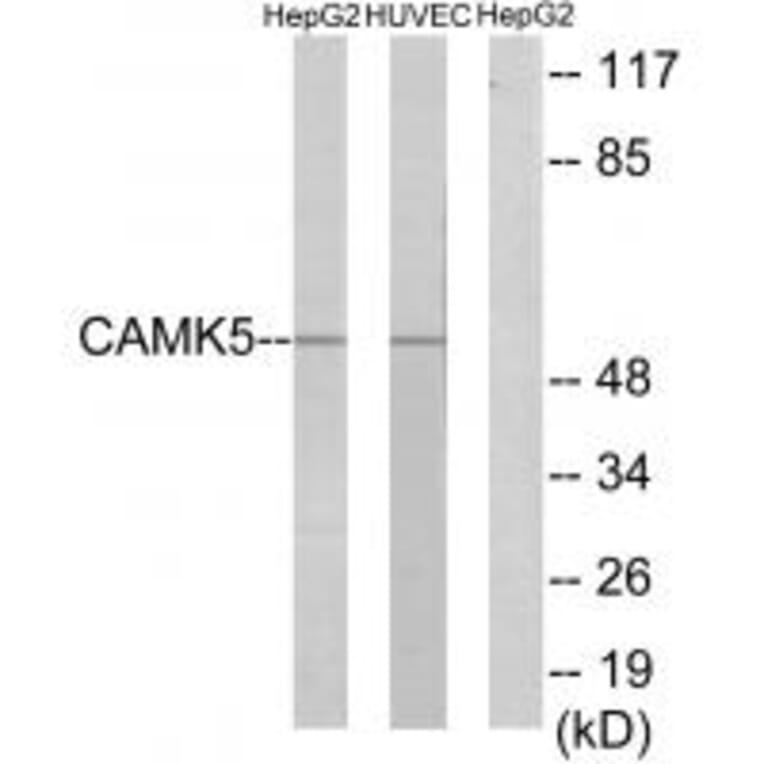 Western blot - CAMK5 Antibody from Signalway Antibody (33970) - Antibodies.com