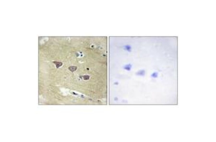Immunohistochemistry - CAMK5 Antibody from Signalway Antibody (33970) - Antibodies.com