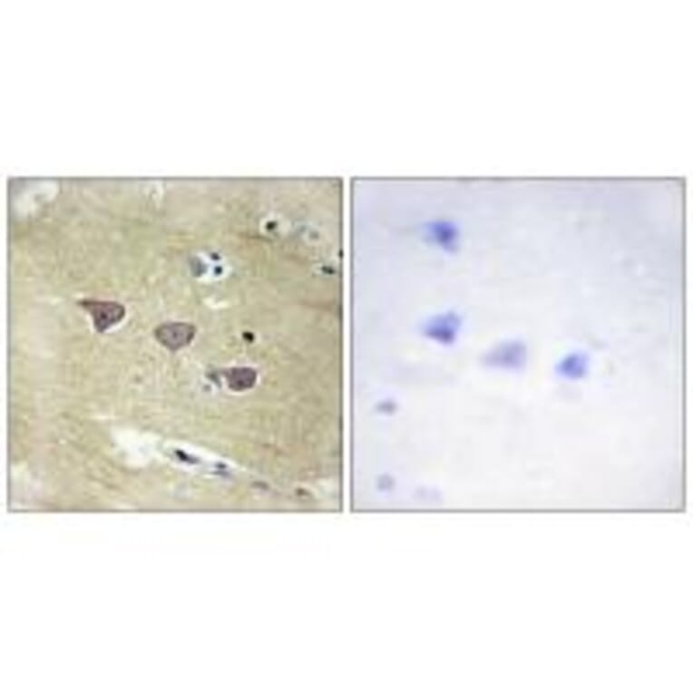 Immunohistochemistry - CAMK5 Antibody from Signalway Antibody (33970) - Antibodies.com
