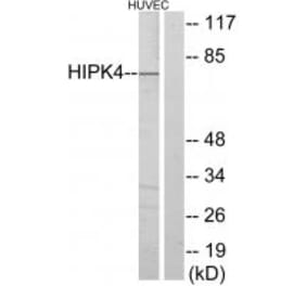Western blot - HIPK4 Antibody from Signalway Antibody (33971) - Antibodies.com