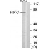 Western blot - HIPK4 Antibody from Signalway Antibody (33971) - Antibodies.com
