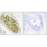Immunohistochemistry - HIPK4 Antibody from Signalway Antibody (33971) - Antibodies.com