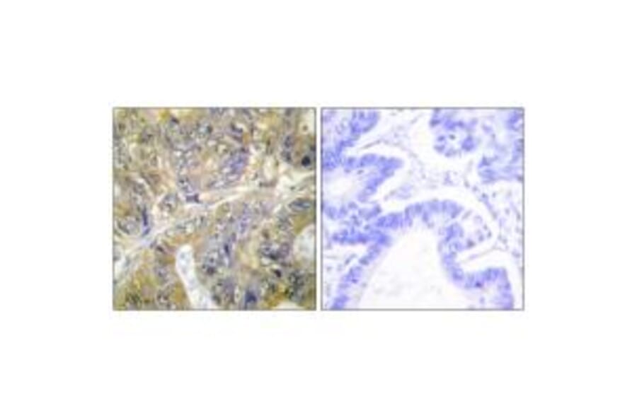 Immunohistochemistry - ES8L3 Antibody from Signalway Antibody (33990) - Antibodies.com