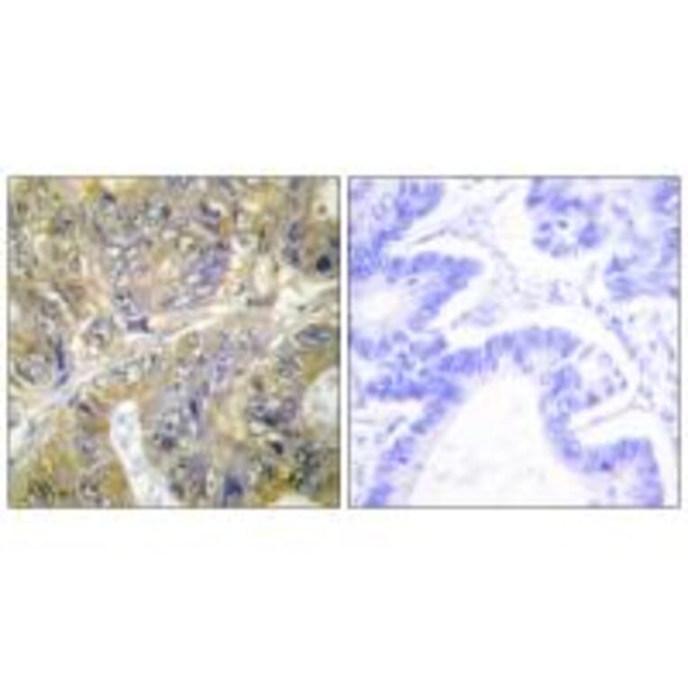 Immunohistochemistry - ES8L3 Antibody from Signalway Antibody (33990) - Antibodies.com