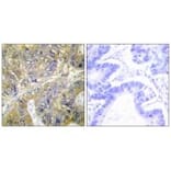 Immunohistochemistry - ES8L3 Antibody from Signalway Antibody (33990) - Antibodies.com