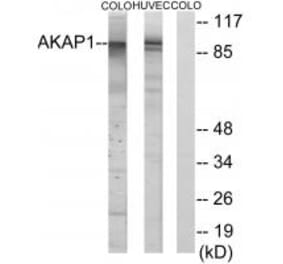 Western blot - AKAP1 Antibody from Signalway Antibody (34003) - Antibodies.com