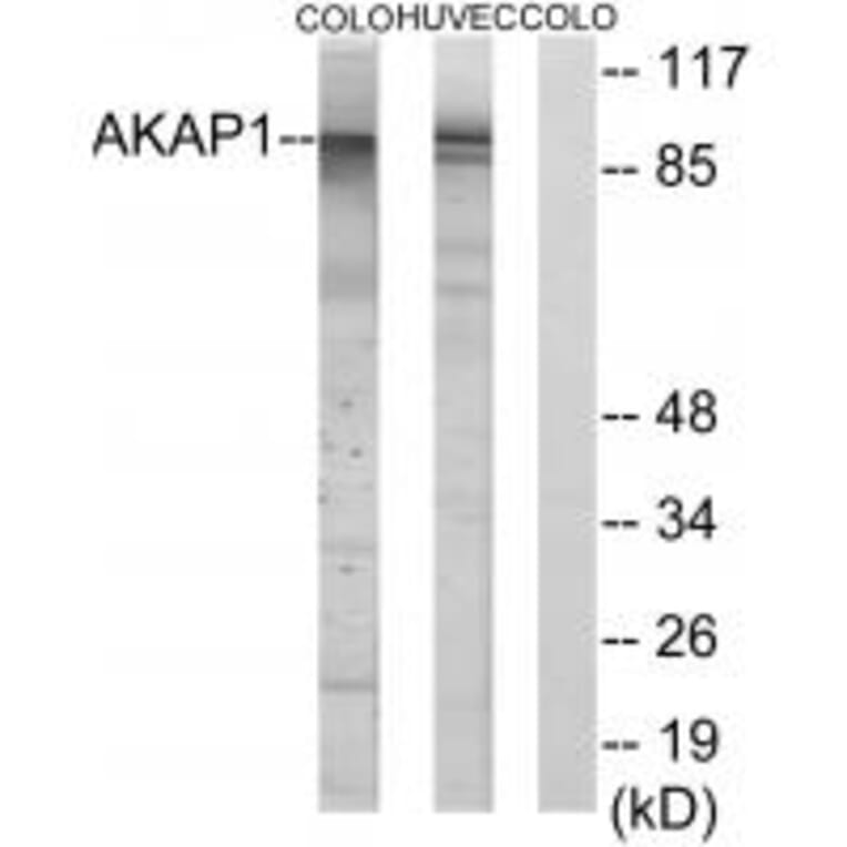 Western blot - AKAP1 Antibody from Signalway Antibody (34003) - Antibodies.com